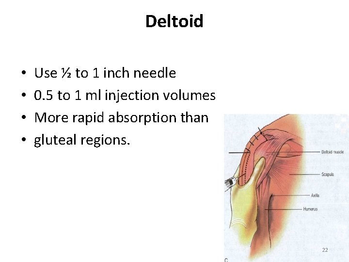 Deltoid • • Use ½ to 1 inch needle 0. 5 to 1 ml