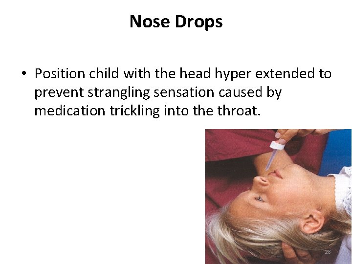 Nose Drops • Position child with the head hyper extended to prevent strangling sensation