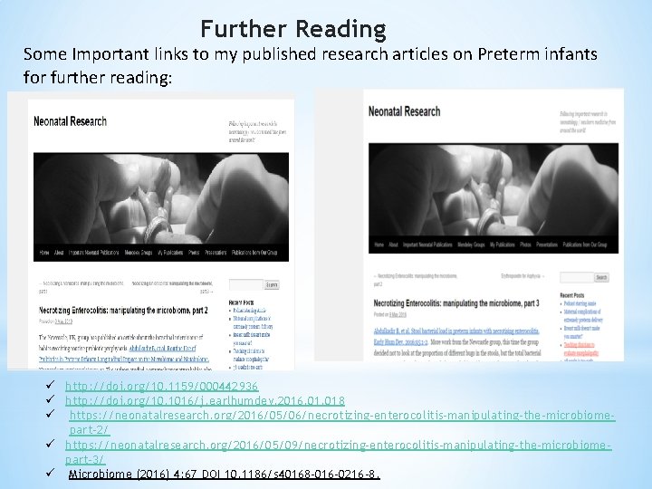 Further Reading Some Important links to my published research articles on Preterm infants for