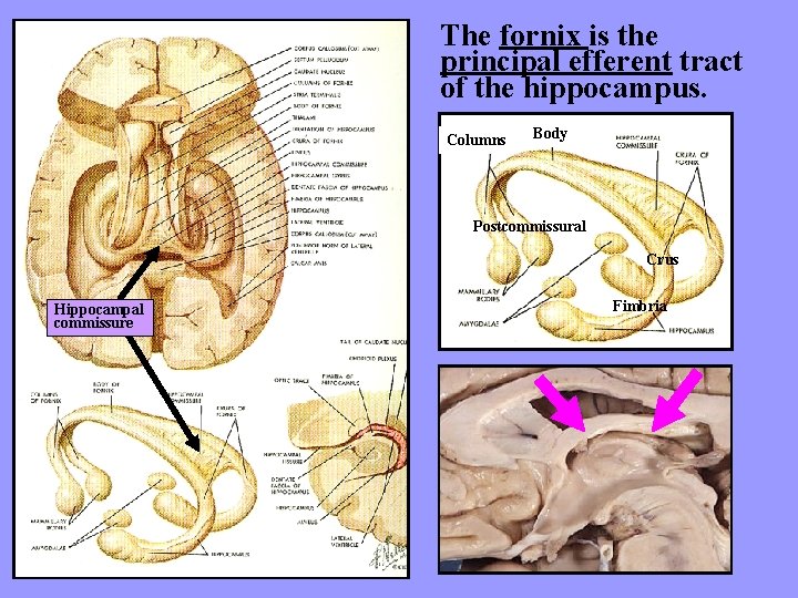 The fornix is the principal efferent tract of the hippocampus. Columns Body Postcommissural Crus
