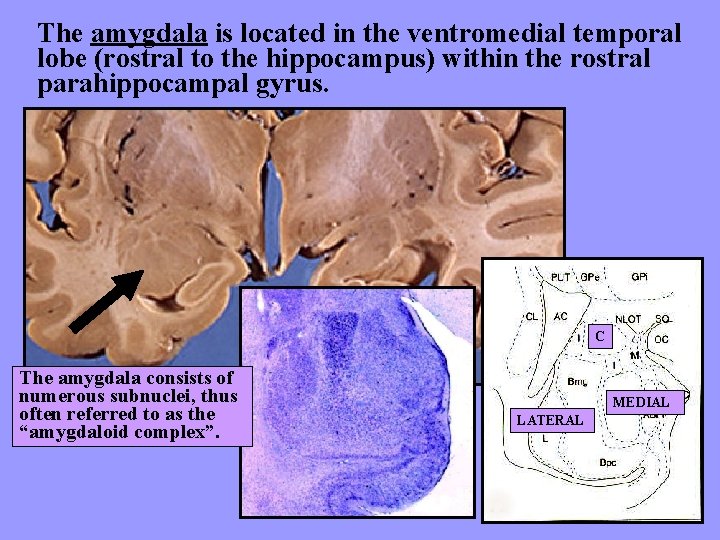 The amygdala is located in the ventromedial temporal lobe (rostral to the hippocampus) within