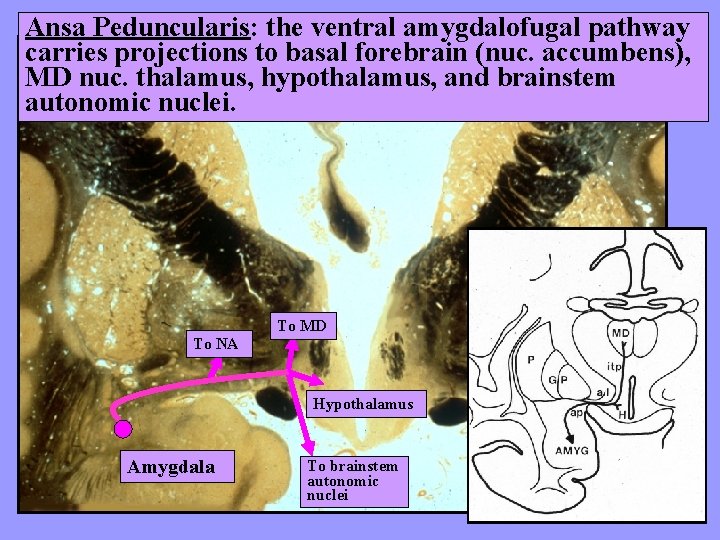 Ansa Peduncularis: the ventral amygdalofugal pathway carries projections to basal forebrain (nuc. accumbens), MD