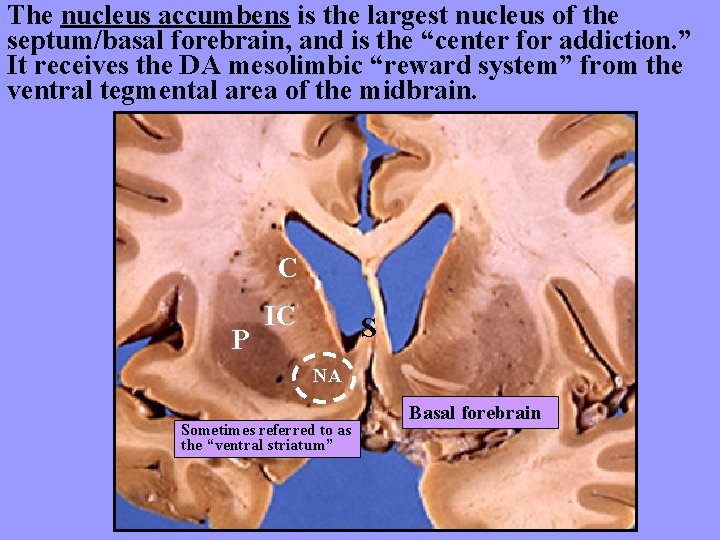 The nucleus accumbens is the largest nucleus of the septum/basal forebrain, and is the
