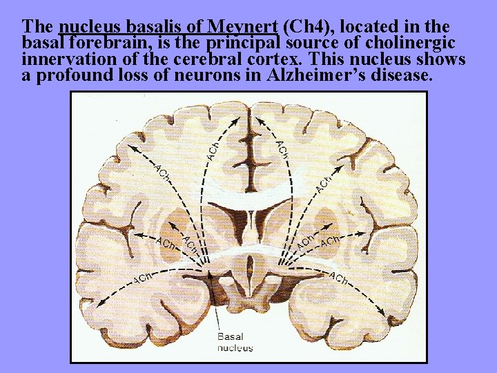 The nucleus basalis of Meynert (Ch 4), located in the basal forebrain, is the