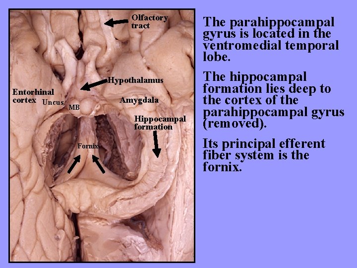 Olfactory tract Hypothalamus Entorhinal cortex Uncus MB Amygdala Hippocampal formation Fornix The parahippocampal gyrus