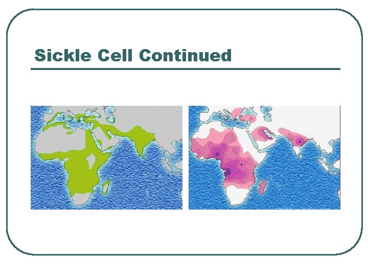 Sickle Cell Continued 