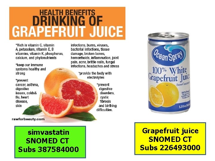simvastatin SNOMED CT Subs 387584000 Grapefruit juice SNOMED CT Subs 226493000 