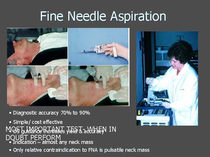 Fine Needle Aspiration • Diagnostic accuracy 70% to 90% • Simple/ cost effective MOST