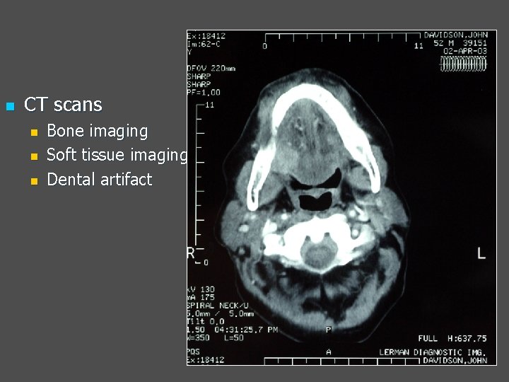 n CT scans n n n Bone imaging Soft tissue imaging Dental artifact 