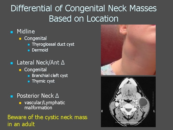 Differential of Congenital Neck Masses Based on Location n Midline n Congenital n n