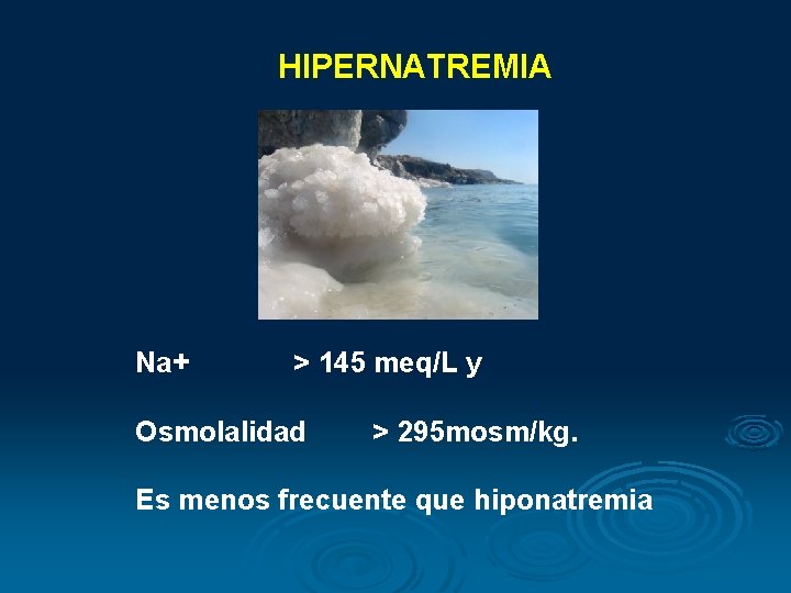 HIPERNATREMIA Na+ > 145 meq/L y Osmolalidad > 295 mosm/kg. Es menos frecuente que HIPERNATREMIA Na+ > 145 meq/L y Osmolalidad > 295 mosm/kg. Es menos frecuente que