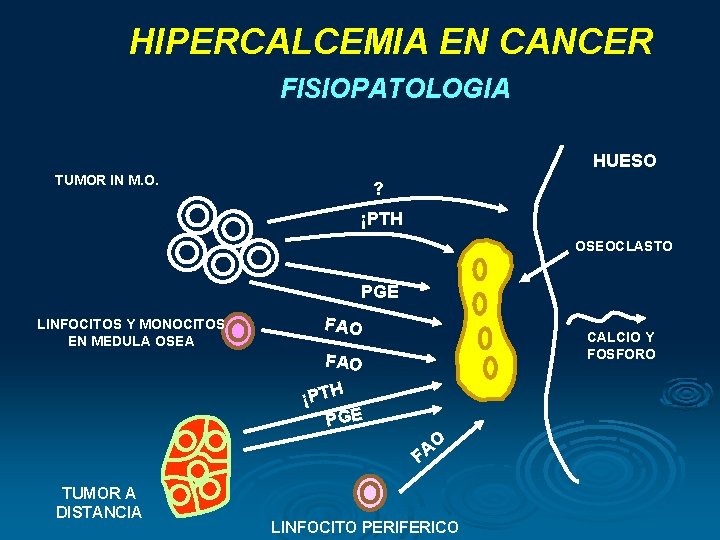 HIPERCALCEMIA EN CANCER FISIOPATOLOGIA HUESO TUMOR IN M. O. ? ¡PTH OSEOCLASTO PGE LINFOCITOS HIPERCALCEMIA EN CANCER FISIOPATOLOGIA HUESO TUMOR IN M. O. ? ¡PTH OSEOCLASTO PGE LINFOCITOS