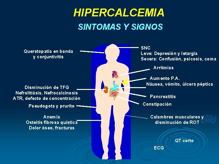 HIPERCALCEMIA SINTOMAS Y SIGNOS Queratopatía en banda y conjuntivitis SNC Leve: Depresión y letargia HIPERCALCEMIA SINTOMAS Y SIGNOS Queratopatía en banda y conjuntivitis SNC Leve: Depresión y letargia