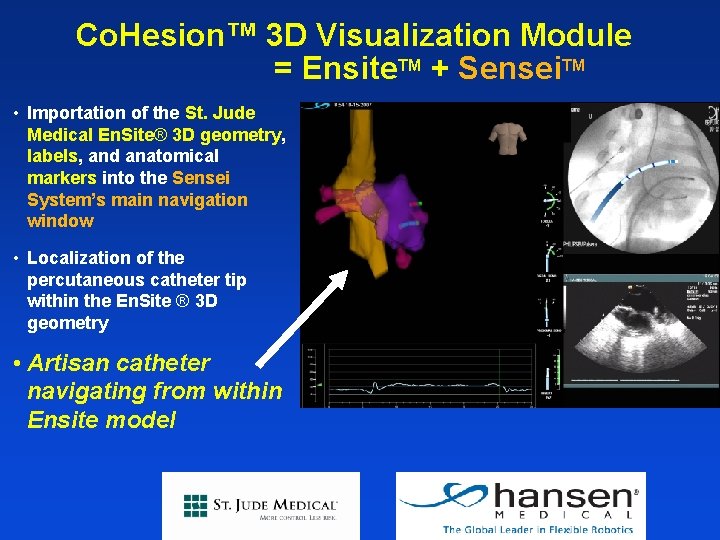 Co. Hesion™ 3 D Visualization Module = Ensite. TM + Sensei. TM • Importation