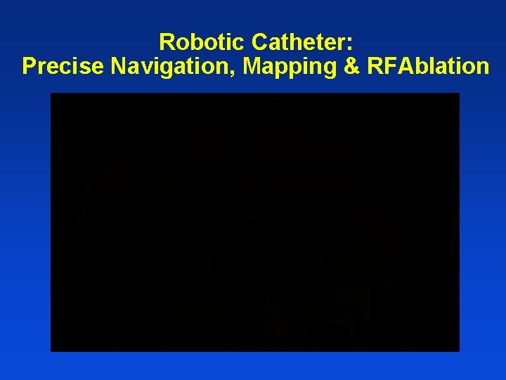 Robotic Catheter: Precise Navigation, Mapping & RFAblation 