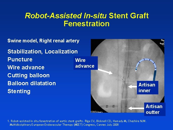 Robot-Assisted In-situ Stent Graft Fenestration Swine model, Right renal artery Stabilization, Localization Puncture Wire