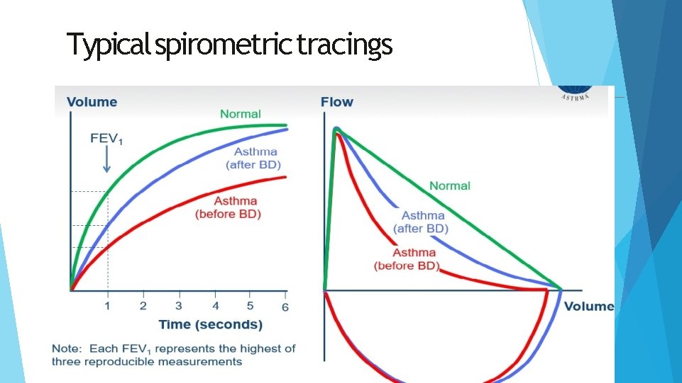Typical spirometric tracings 