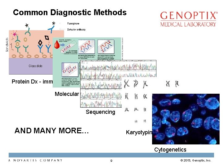 Common Diagnostic Methods Protein Dx - immunoassay Molecular Dx - PCR Sequencing AND MANY