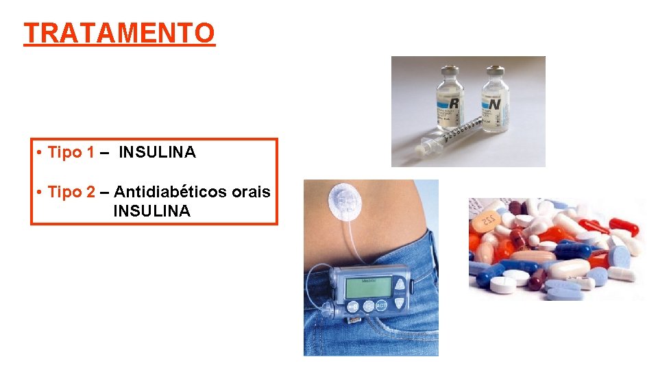 TRATAMENTO • Tipo 1 – INSULINA • Tipo 2 – Antidiabéticos orais INSULINA 