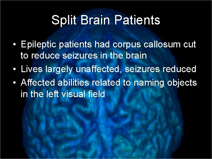 Split Brain Patients • Epileptic patients had corpus callosum cut to reduce seizures in