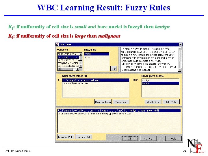 WBC Learning Result: Fuzzy Rules R 1: if uniformity of cell size is small