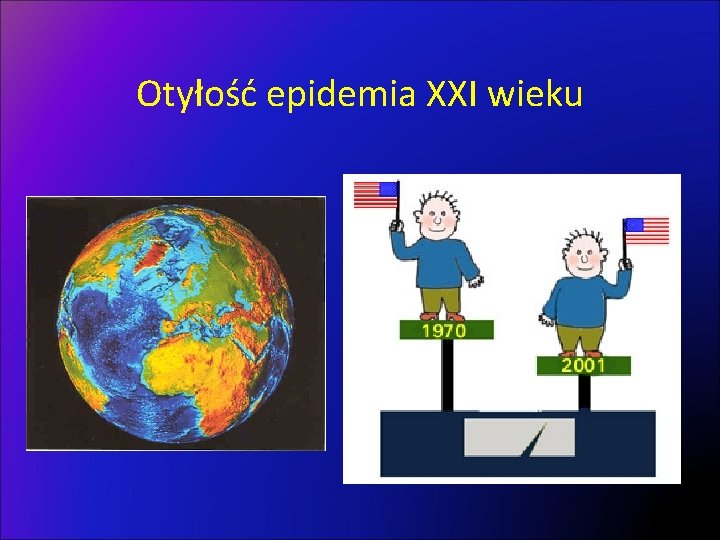 Otyłość epidemia XXI wieku 