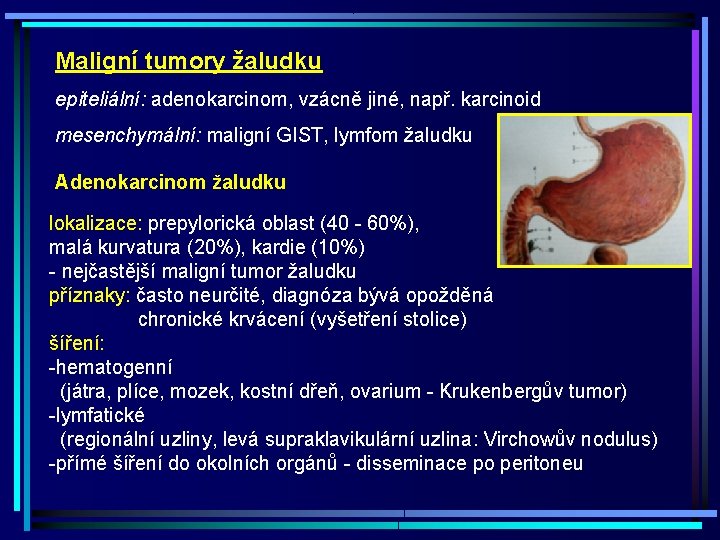 Maligní tumory žaludku epiteliální: adenokarcinom, vzácně jiné, např. karcinoid mesenchymální: maligní GIST, lymfom žaludku