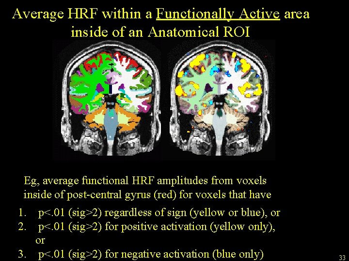 Average HRF within a Functionally Active area inside of an Anatomical ROI Eg, average
