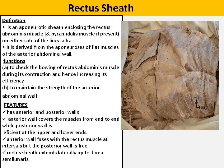  Rectus Sheath Definition § is an aponeurotic sheath enclosing the rectus abdominis muscle