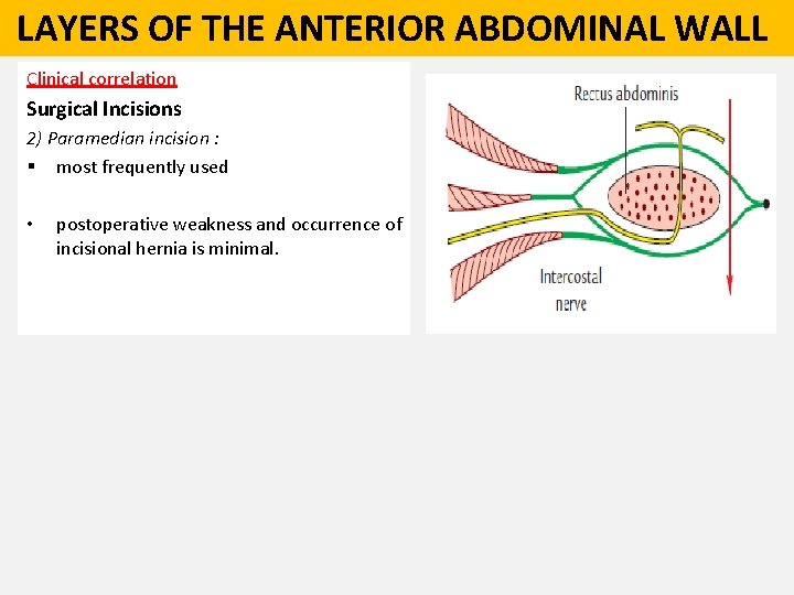  LAYERS OF THE ANTERIOR ABDOMINAL WALL Clinical correlation Surgical Incisions 2) Paramedian incision