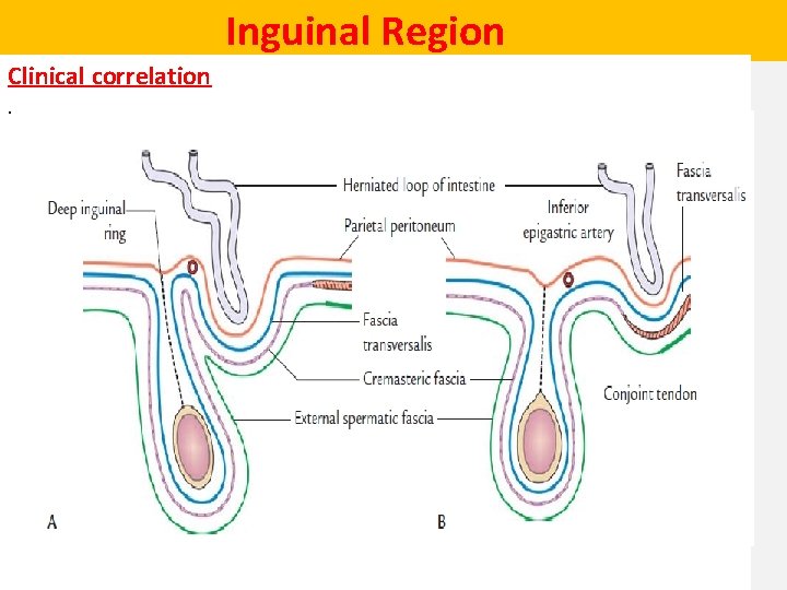  Inguinal Region Clinical correlation. 