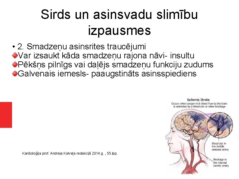 Sirds un asinsvadu slimību izpausmes • 2. Smadzeņu asinsrites traucējumi Var izsaukt kāda smadzeņu