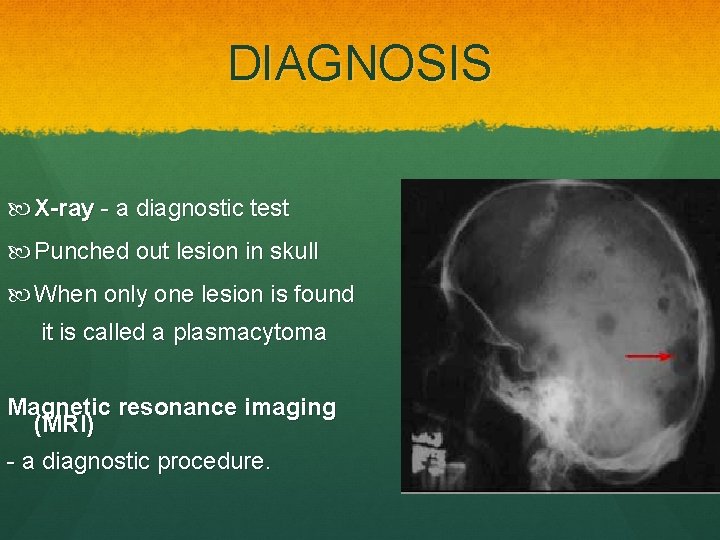 DIAGNOSIS X-ray - a diagnostic test Punched out lesion in skull When only one