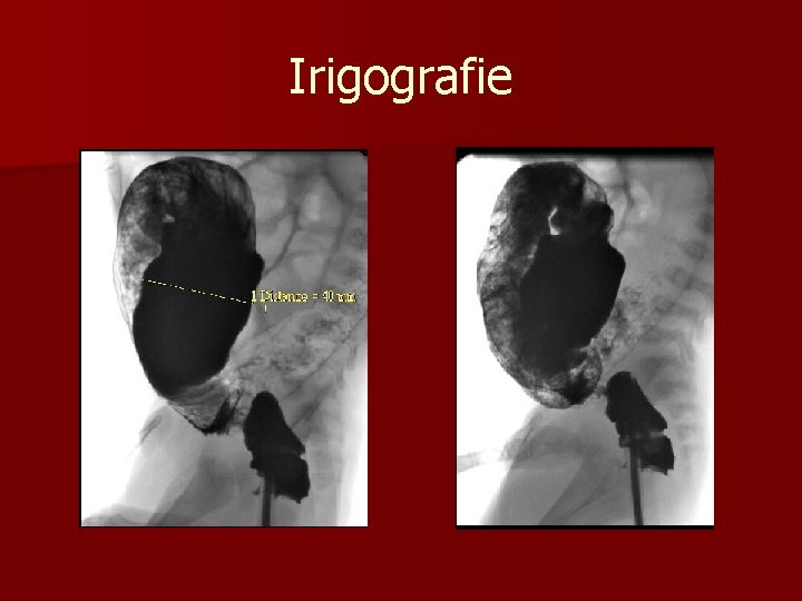 Irigografie n 