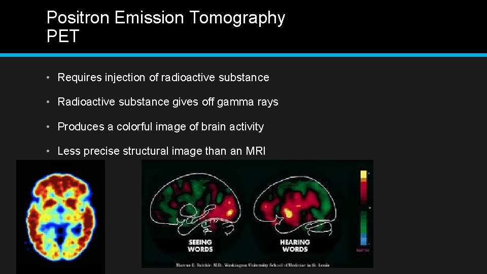 Positron Emission Tomography PET • Requires injection of radioactive substance • Radioactive substance gives