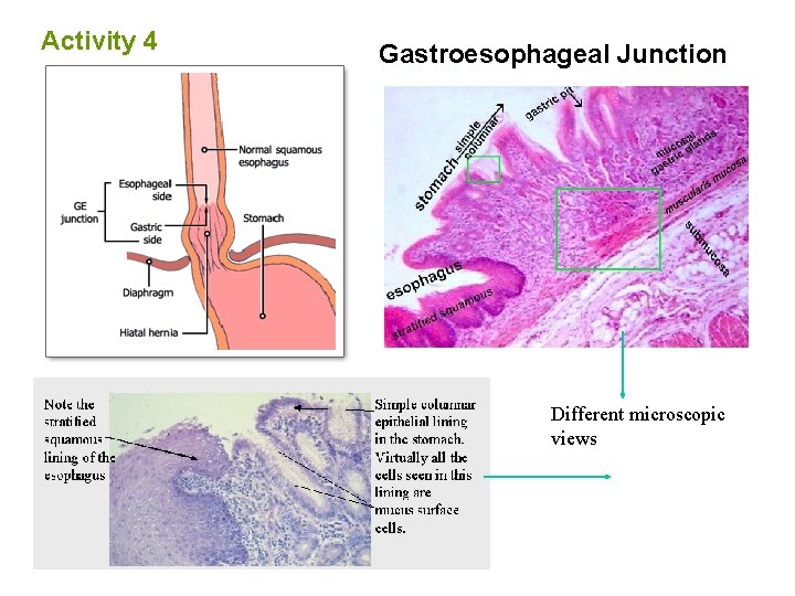 Activity 4 Gastroesophageal Junction Different microscopic views 
