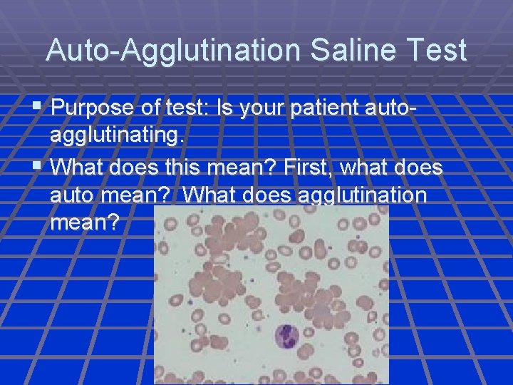 Auto-Agglutination Saline Test Purpose of test: Is your patient autoagglutinating. What does this mean?