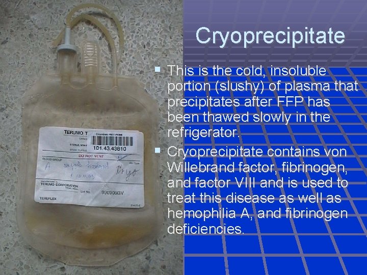 Cryoprecipitate This is the cold, insoluble portion (slushy) of plasma that precipitates after FFP
