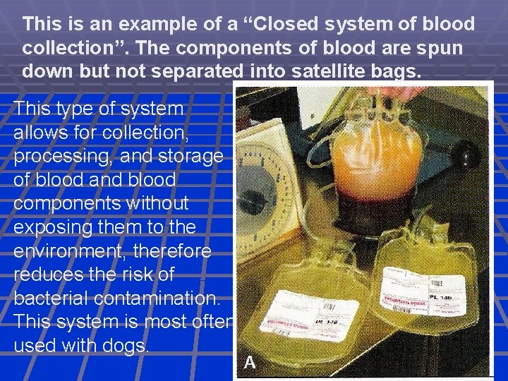 This is an example of a “Closed system of blood collection”. The components of