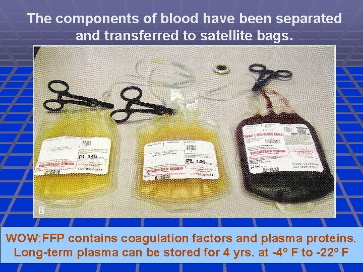 The components of blood have been separated and transferred to satellite bags. WOW: FFP