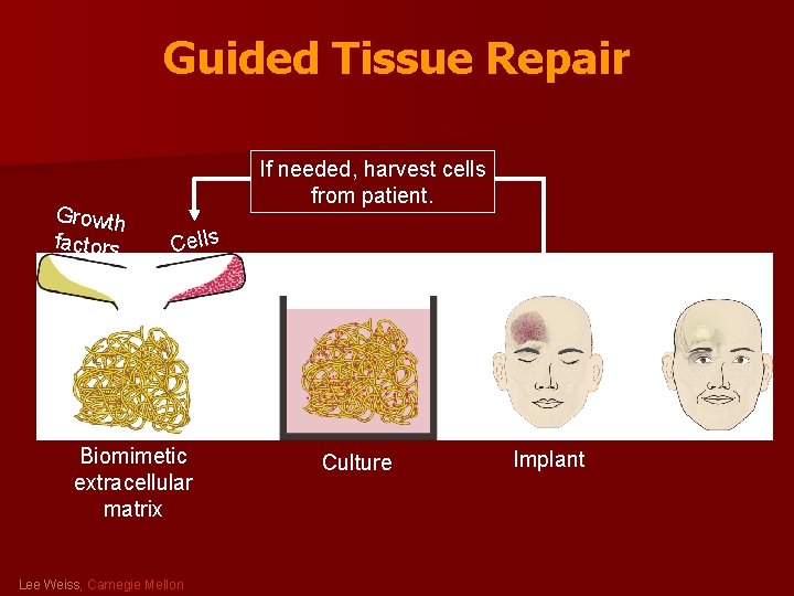 Guided Tissue Repair Growth factors If needed, harvest cells from patient. Cells Biomimetic extracellular