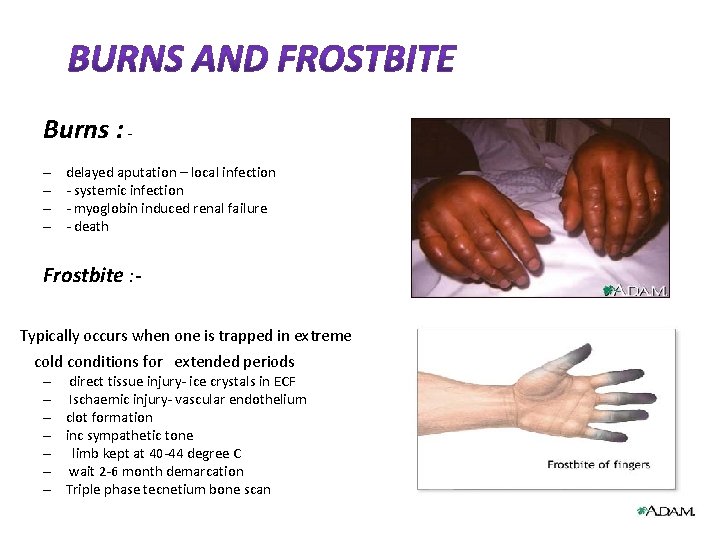 Burns : – – delayed aputation – local infection - systemic infection - myoglobin