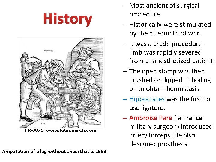 History Amputation of a leg without anaesthetic, 1593 – Most ancient of surgical procedure.