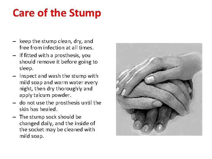 Care of the Stump – keep the stump clean, dry, and free from infection