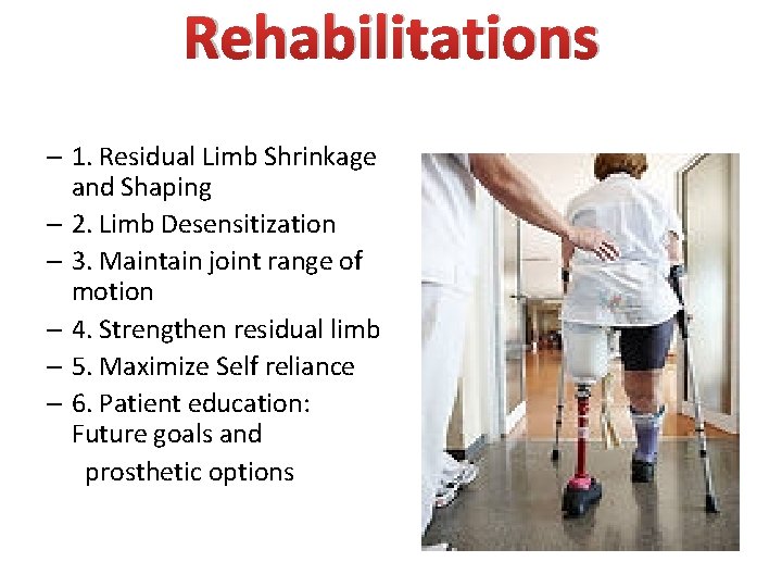 Rehabilitations – 1. Residual Limb Shrinkage and Shaping – 2. Limb Desensitization – 3.