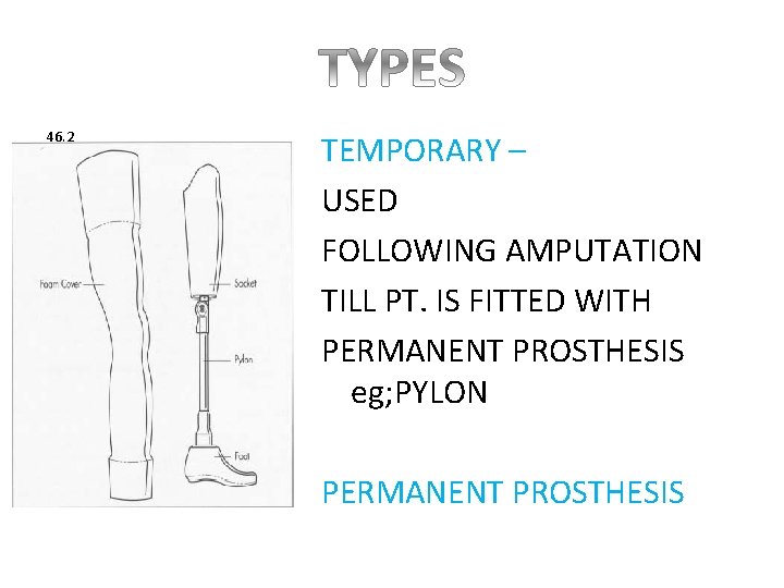 46. 2 TEMPORARY – USED FOLLOWING AMPUTATION TILL PT. IS FITTED WITH PERMANENT PROSTHESIS
