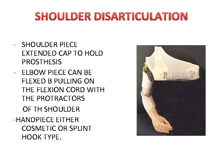SHOULDER DISARTICULATION - SHOULDER PIECE EXTENDED CAP TO HOLD PROSTHESIS - ELBOW PIECE CAN