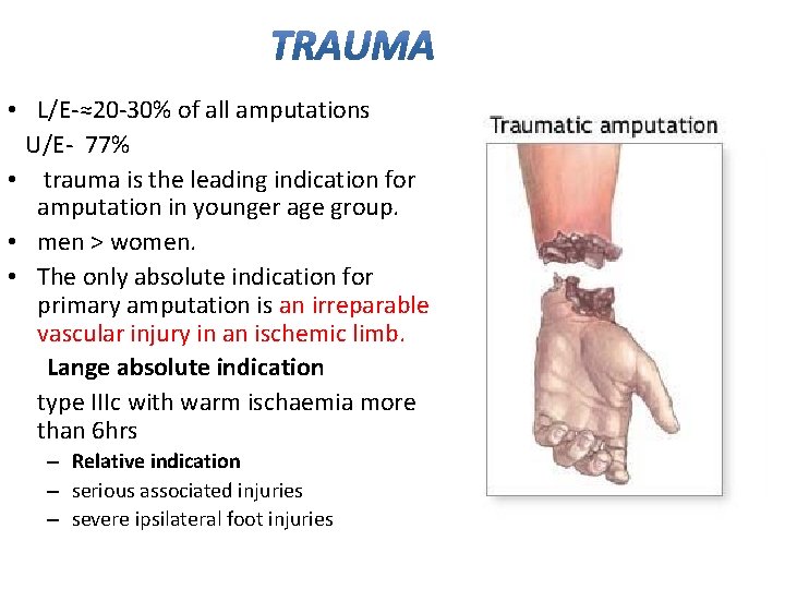  • L/E-≈20 -30% of all amputations U/E- 77% • trauma is the leading