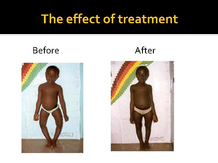 The effect of treatment Before After 