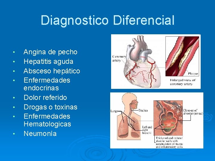 Diagnostico Diferencial • • Angina de pecho Hepatitis aguda Absceso hepático Enfermedades endocrinas Dolor